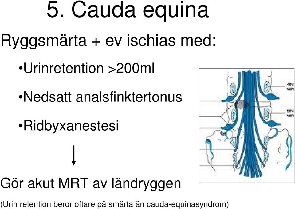 Ridbyxanestesi Gör akut MRT av ländryggen (Urin