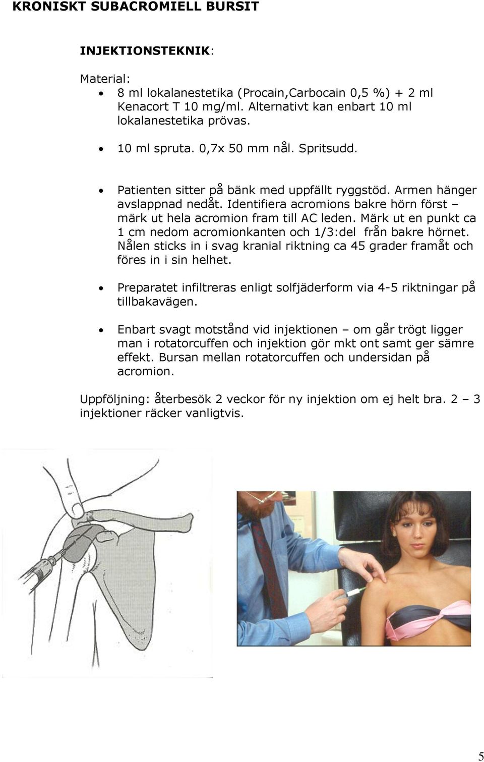 Märk ut en punkt ca 1 cm nedom acromionkanten och 1/3:del från bakre hörnet. Nålen sticks in i svag kranial riktning ca 45 grader framåt och föres in i sin helhet.