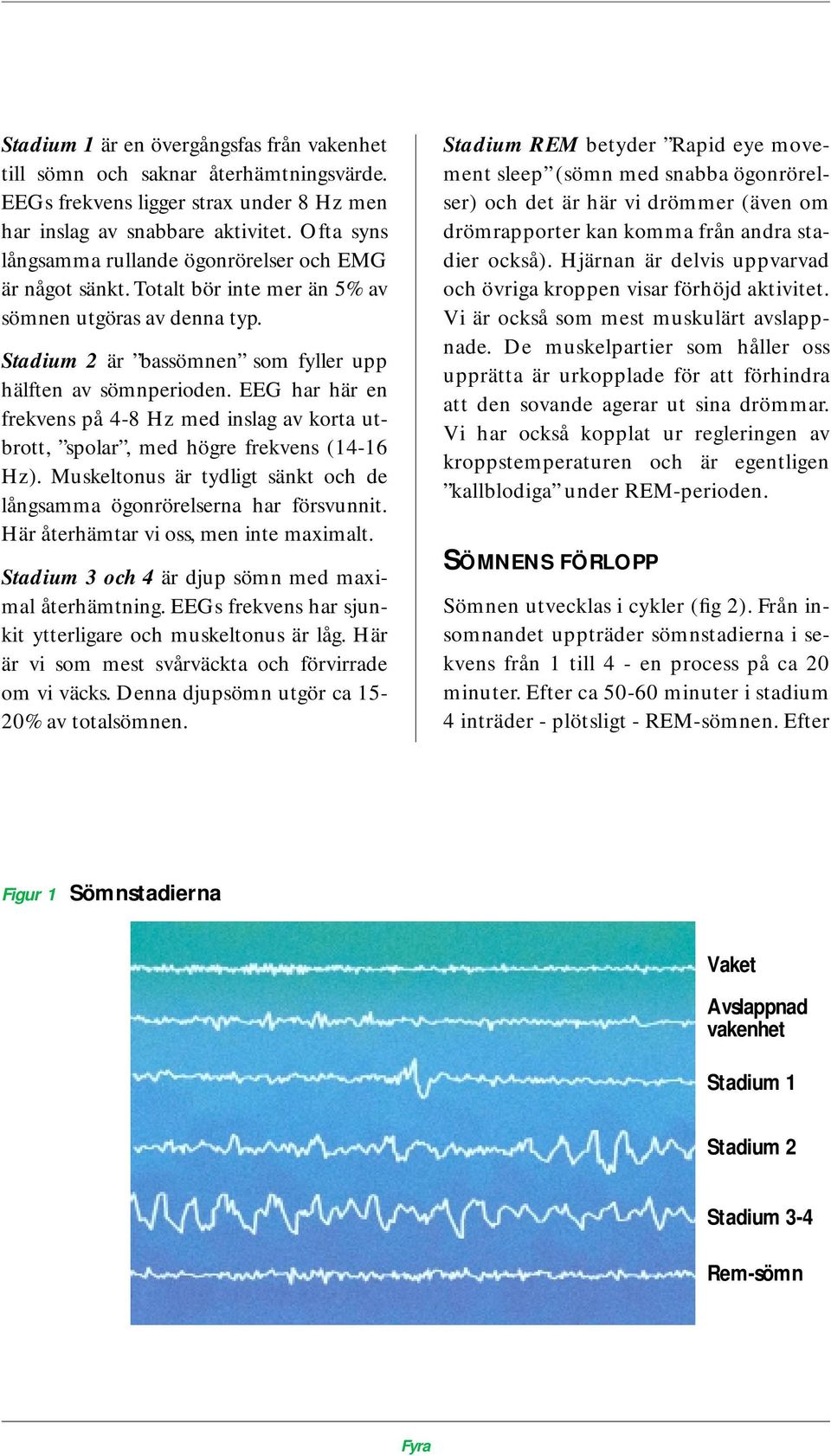 EEG har här en frekvens på 4-8 Hz med inslag av korta utbrott, spolar, med högre frekvens (14-16 Hz). Muskeltonus är tydligt sänkt och de långsamma ögonrörelserna har försvunnit.