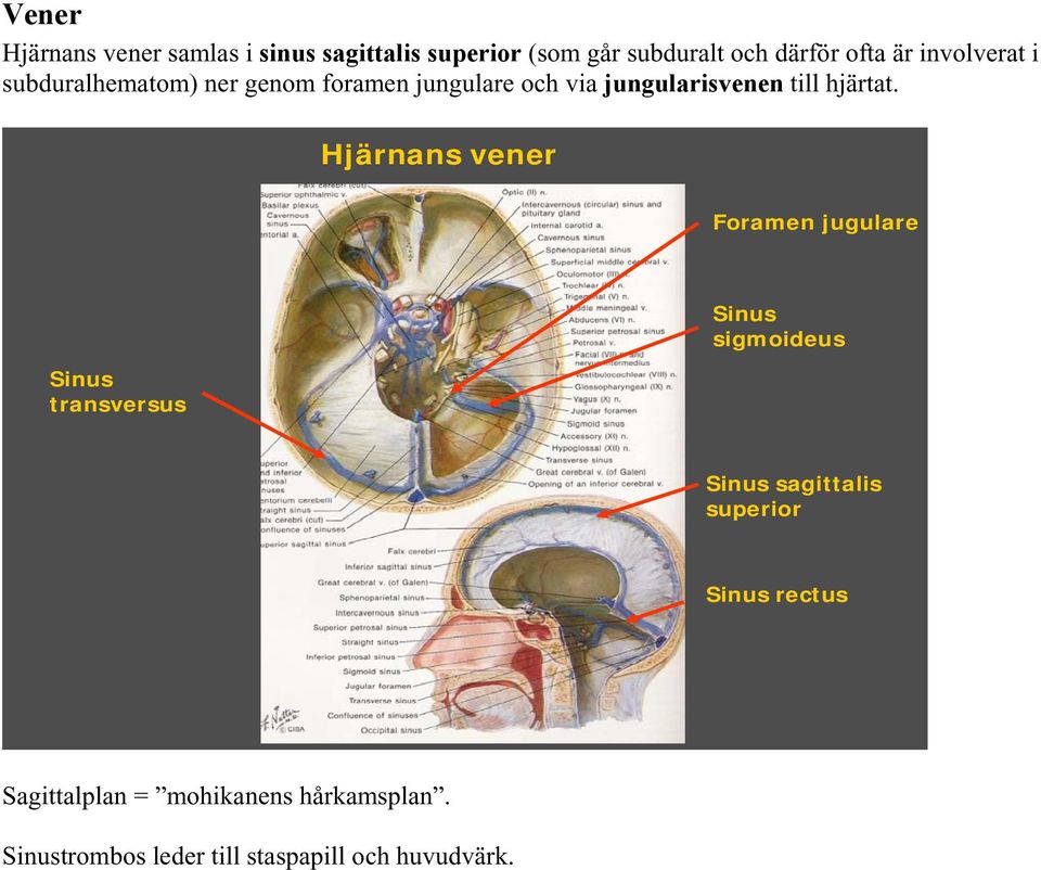 Hjärnans vener Foramen jugulare Sinus transversus Sinus sigmoideus Sinus sagittalis superior