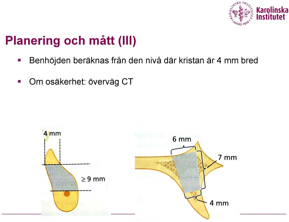 den nivå där kristan är 4