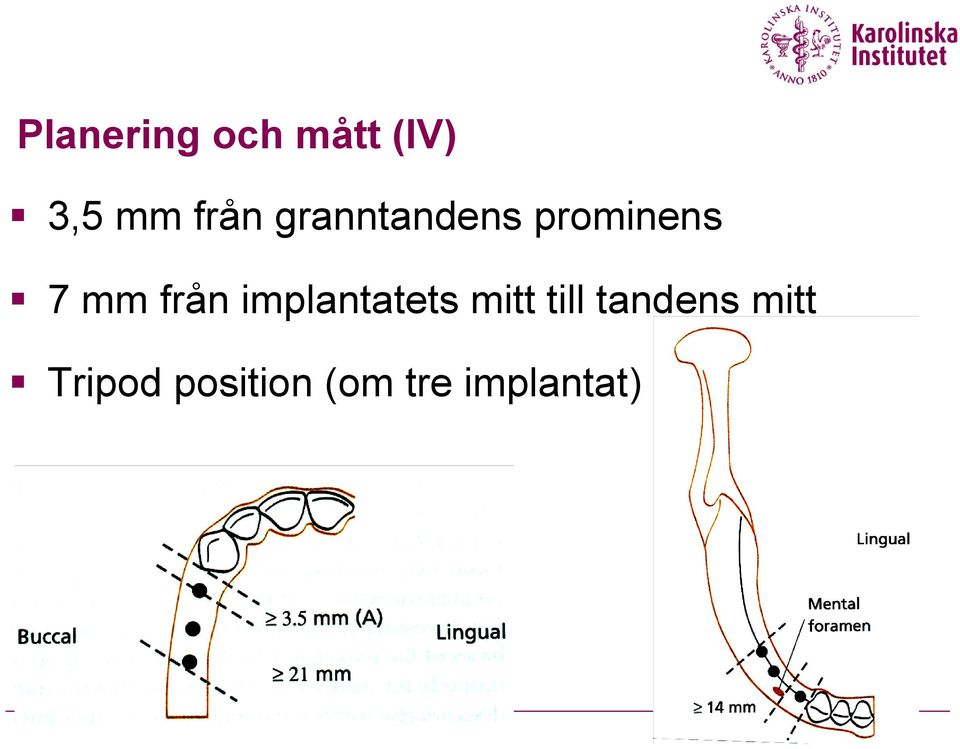 från implantatets mitt till