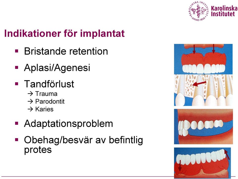 Trauma Parodontit Karies