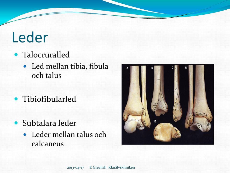 talus Tibiofibularled