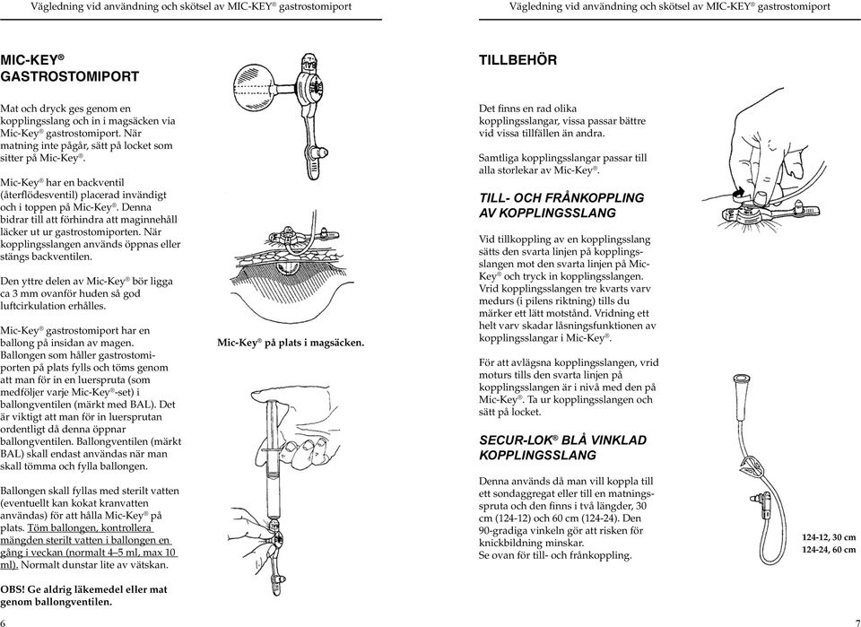 När kopplingsslangen används öppnas eller stängs backventilen. Den yttre delen av Mic-Key bör ligga ca 3 mm ovanför huden så god luftcirkulation erhålles.