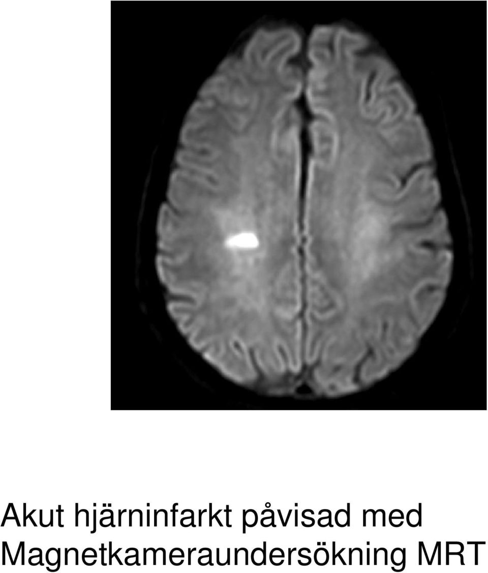 påvisad med