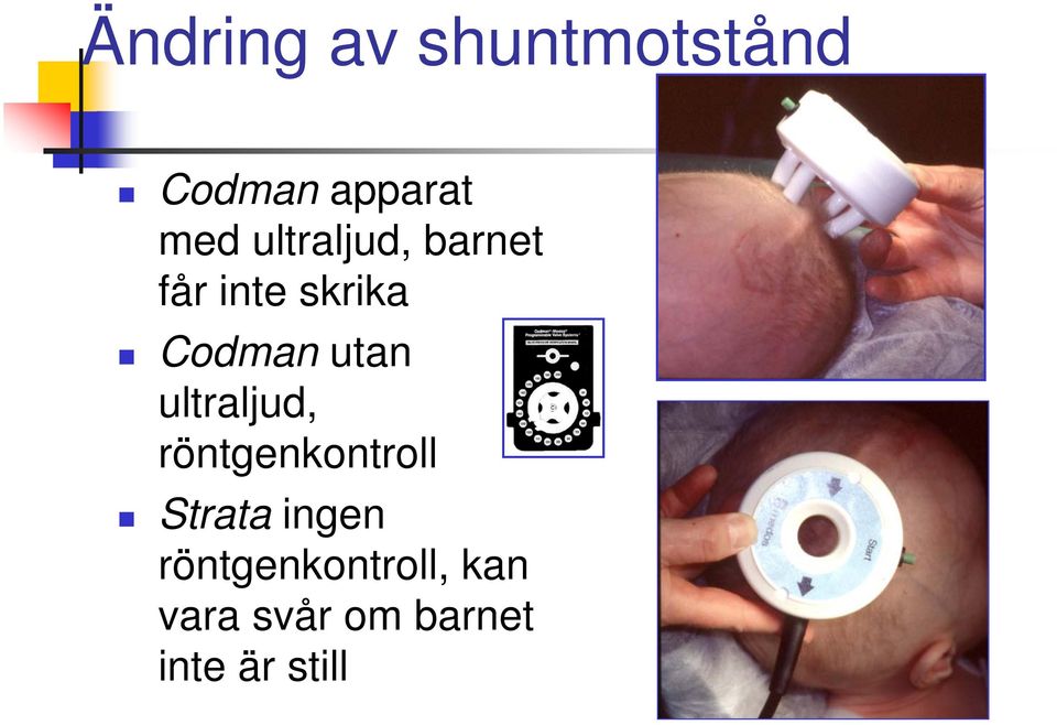 ultraljud, röntgenkontroll Strata ingen