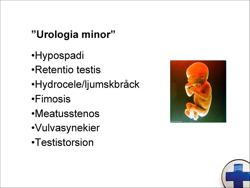 Hydrocele/ljumskbråck