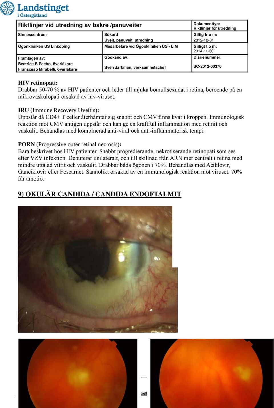 Immunologisk reaktion mot CMV antigen uppstår och kan ge en kraftfull inflammation med retinit och vaskulit. Behandlas med kombinerad anti-viral och anti-inflammatorisk terapi.