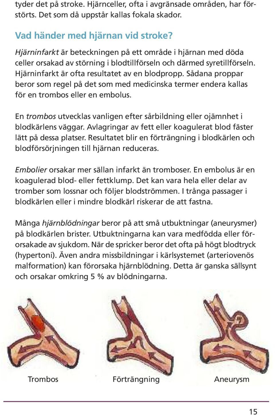 Sådana proppar beror som regel på det som med medicinska termer endera kallas för en trombos eller en embolus. En trombos utvecklas vanligen efter sårbildning eller ojämnhet i blodkärlens väggar.