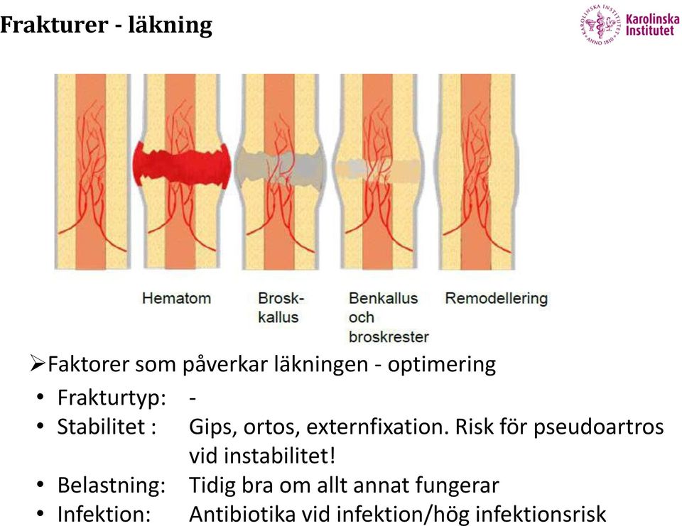 Risk för pseudoartros vid instabilitet!