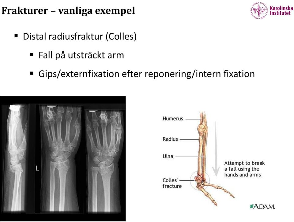 utsträckt arm