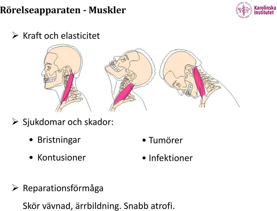 Bristningar Kontusioner Tumörer Infektioner