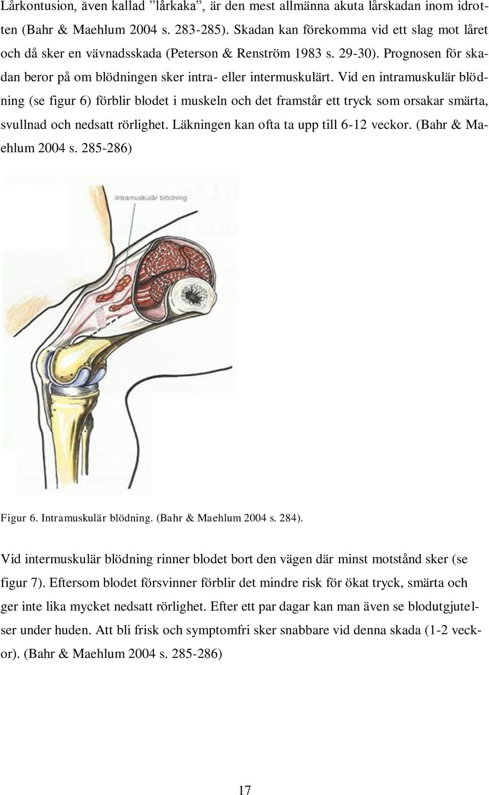 Vid en intramuskulär blödning (se figur 6) förblir blodet i muskeln och det framstår ett tryck som orsakar smärta, svullnad och nedsatt rörlighet. Läkningen kan ofta ta upp till 6-12 veckor.