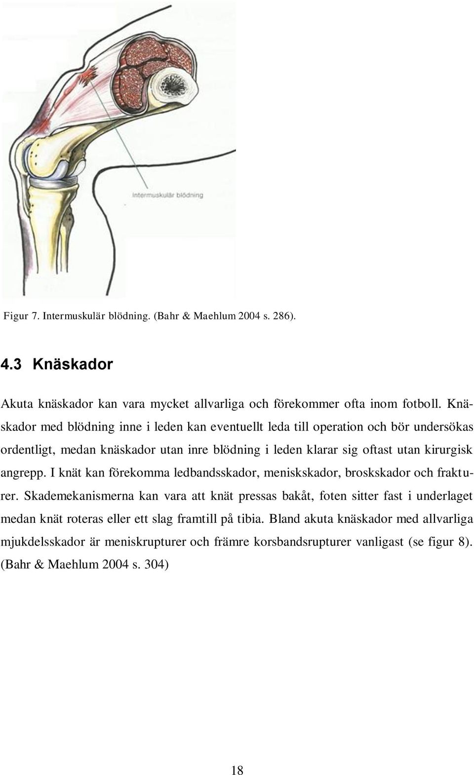 kirurgisk angrepp. I knät kan förekomma ledbandsskador, meniskskador, broskskador och frakturer.