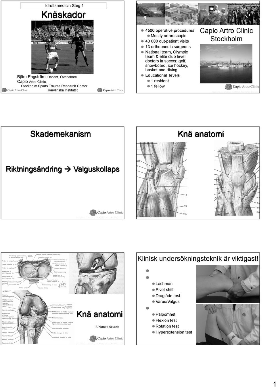 Trauma Research Center Karolinska Institutet Skademekanism Capio Artro Clinic Stockholm Knä anatomi Riktningsändring à Valguskollaps Klinisk undersökningsteknik är viktigast