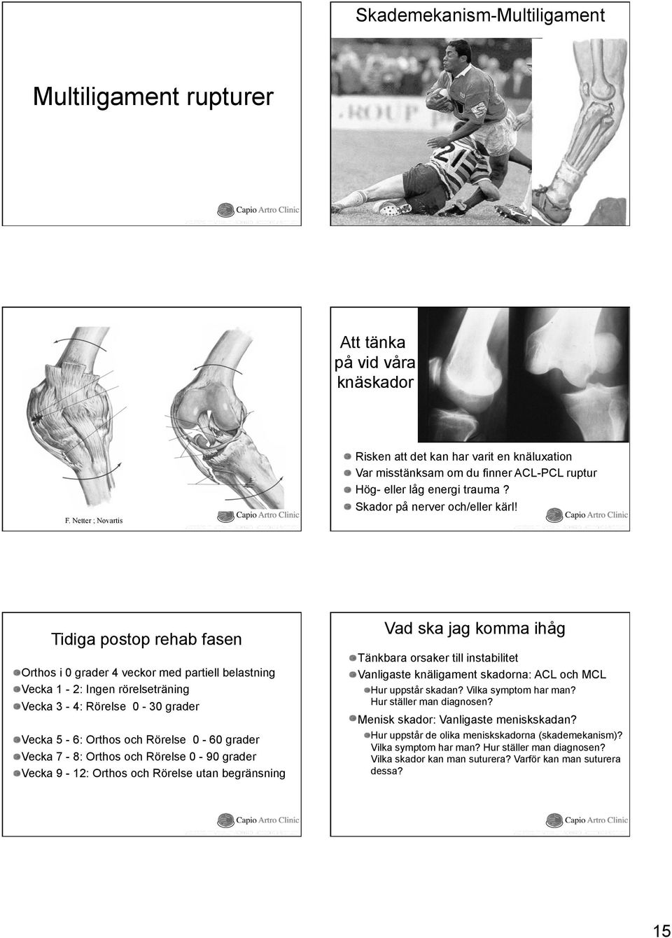 Skador på nerver och/eller kärl Tidiga postop rehab fasen Orthos i 0 grader 4 veckor med partiell belastning Vecka 1-2: Ingen rörelseträning Vecka 3-4: Rörelse 0-30 grader Vecka 5-6: Orthos och