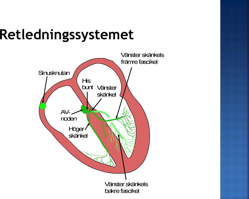 Sinusknutan His bunt Vänster