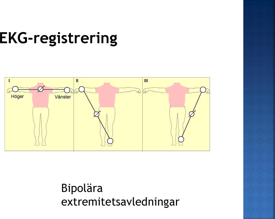 Vänster Bipolära