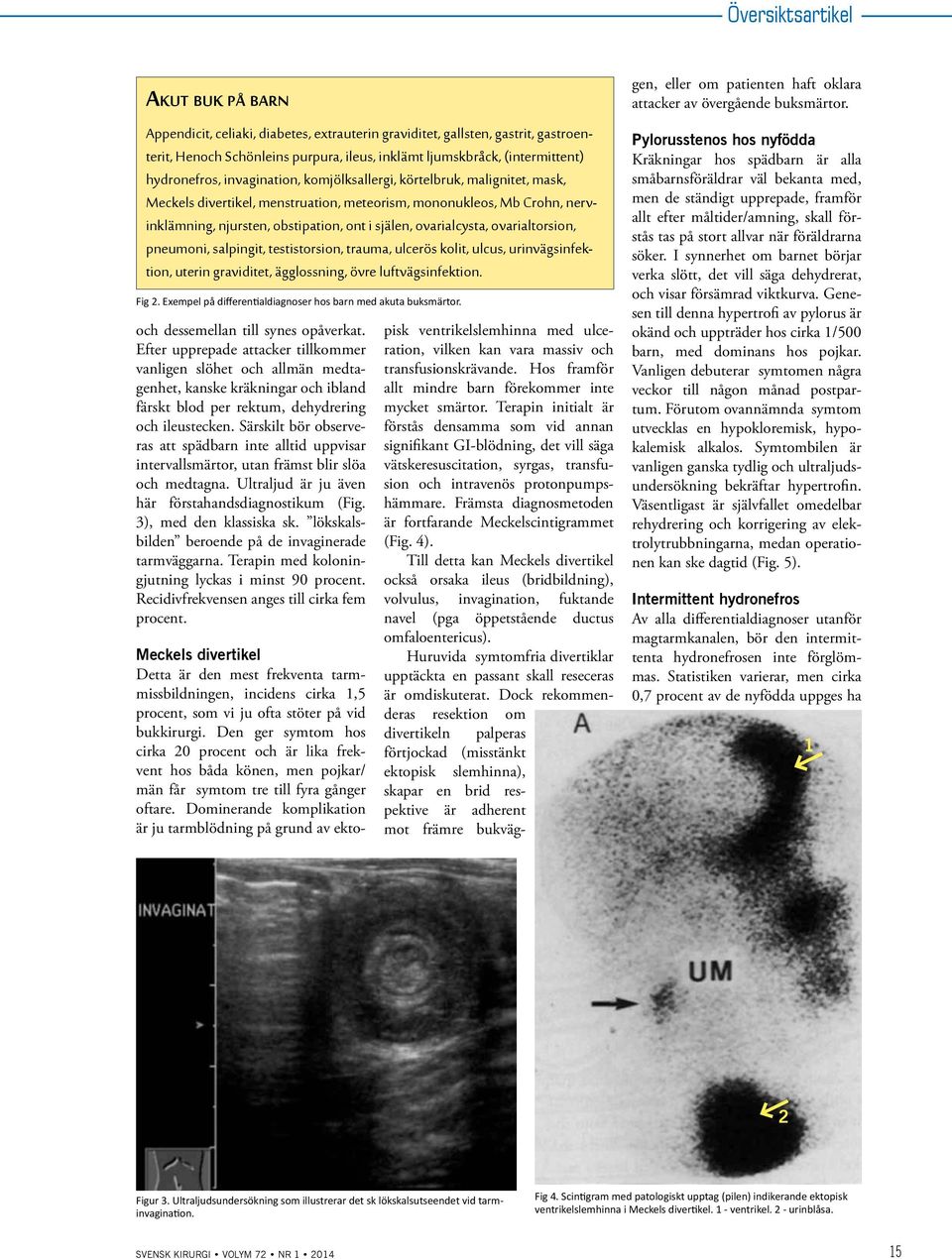 ovarialcysta, ovarialtorsion, pneumoni, salpingit, testistorsion, trauma, ulcerös kolit, ulcus, urinvägsinfektion, uterin graviditet, ägglossning, övre luftvägsinfektion. Fig 2.