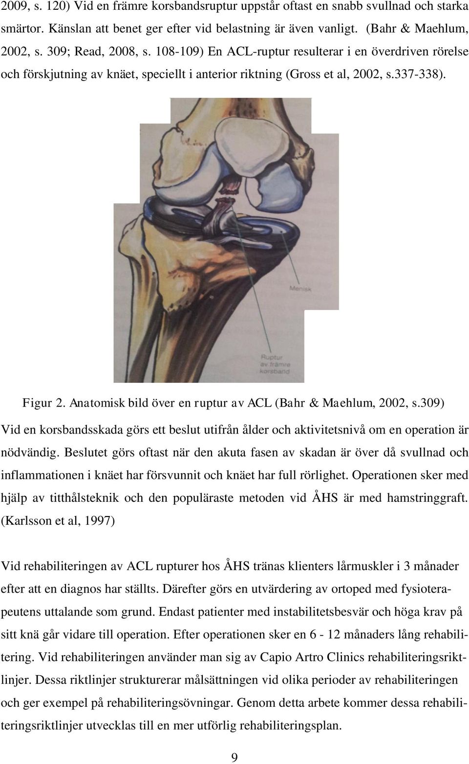 Anatomisk bild över en ruptur av ACL (Bahr & Maehlum, 2002, s.309) Vid en korsbandsskada görs ett beslut utifrån ålder och aktivitetsnivå om en operation är nödvändig.