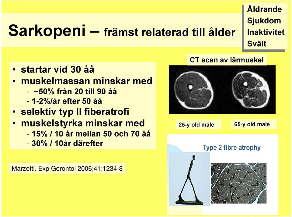 med --15% 15% // 10 10 år år mellan 50 50 och och 70 70 åå åå --30% 30% // 10år 10år därefter CT scan av