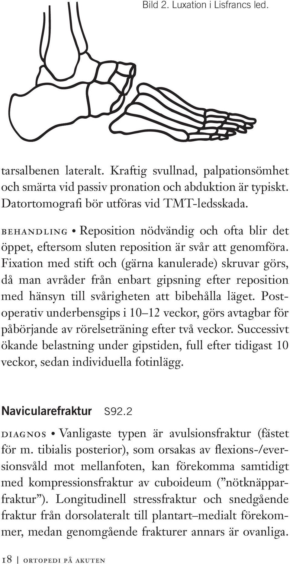 Fixation med stift och (gärna kanulerade) skruvar görs, då man avråder från enbart gipsning efter reposition med hänsyn till svårigheten att bibehålla läget.