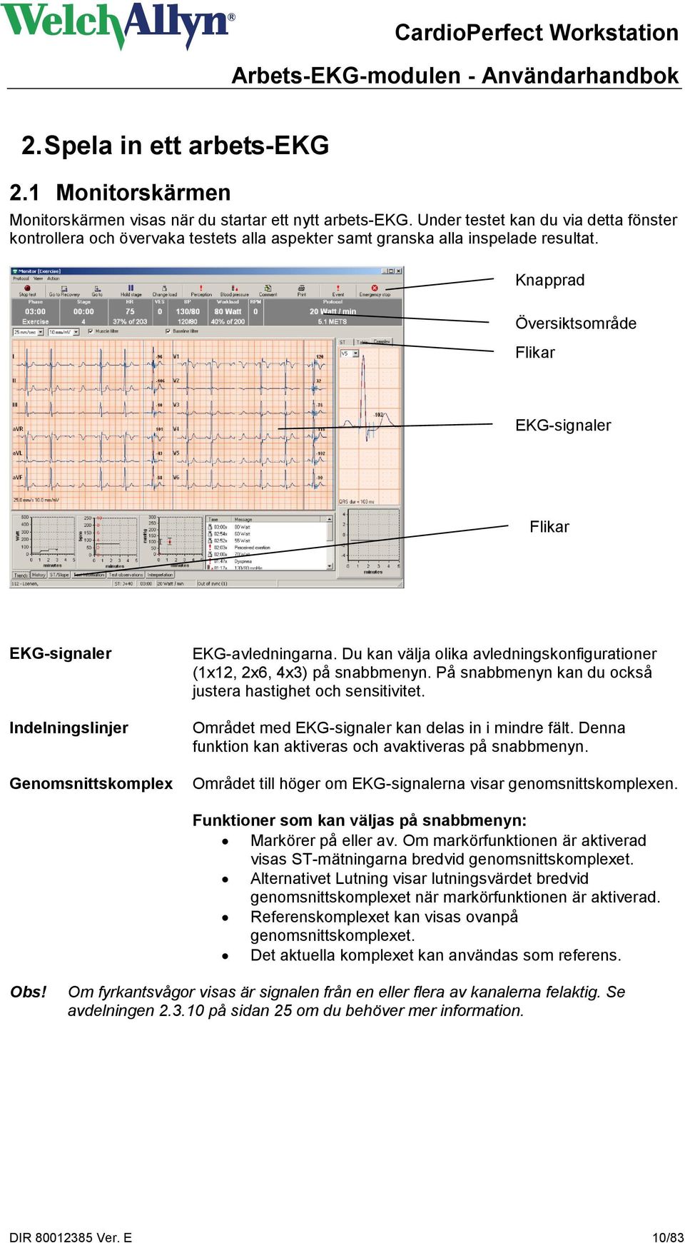 Knapprad Översiktsområde Flikar EKG-signaler Flikar EKG-signaler Indelningslinjer Genomsnittskomplex EKG-avledningarna. Du kan välja olika avledningskonfigurationer (1x12, 2x6, 4x3) på snabbmenyn.