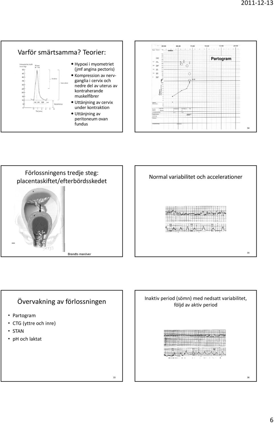 muskelfibrer Uttänjning av cervix under kontraktion Uttänjning av peritoneum ovan fundus Partogram 34 Förlossningens tredje steg: