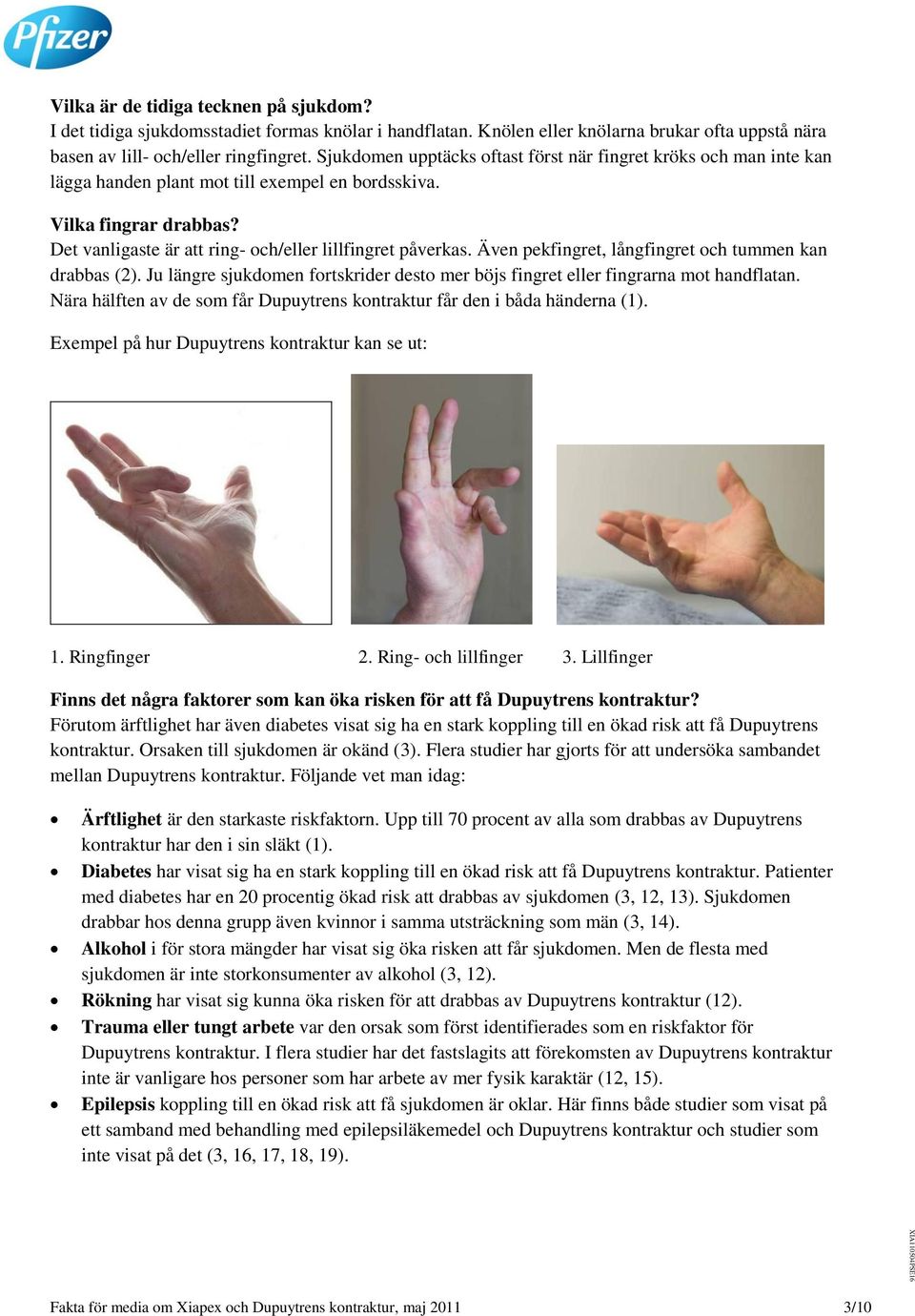 Även pekfingret, långfingret och tummen kan drabbas (2). Ju längre sjukdomen fortskrider desto mer böjs fingret eller fingrarna mot handflatan.