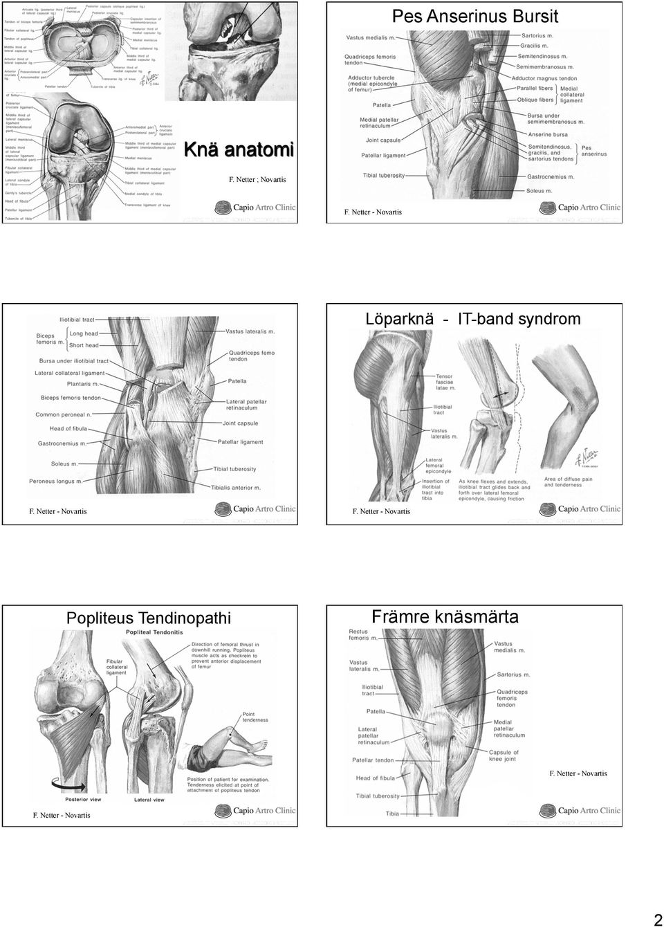 Netter - Novartis Popliteus Tendinopathi F.