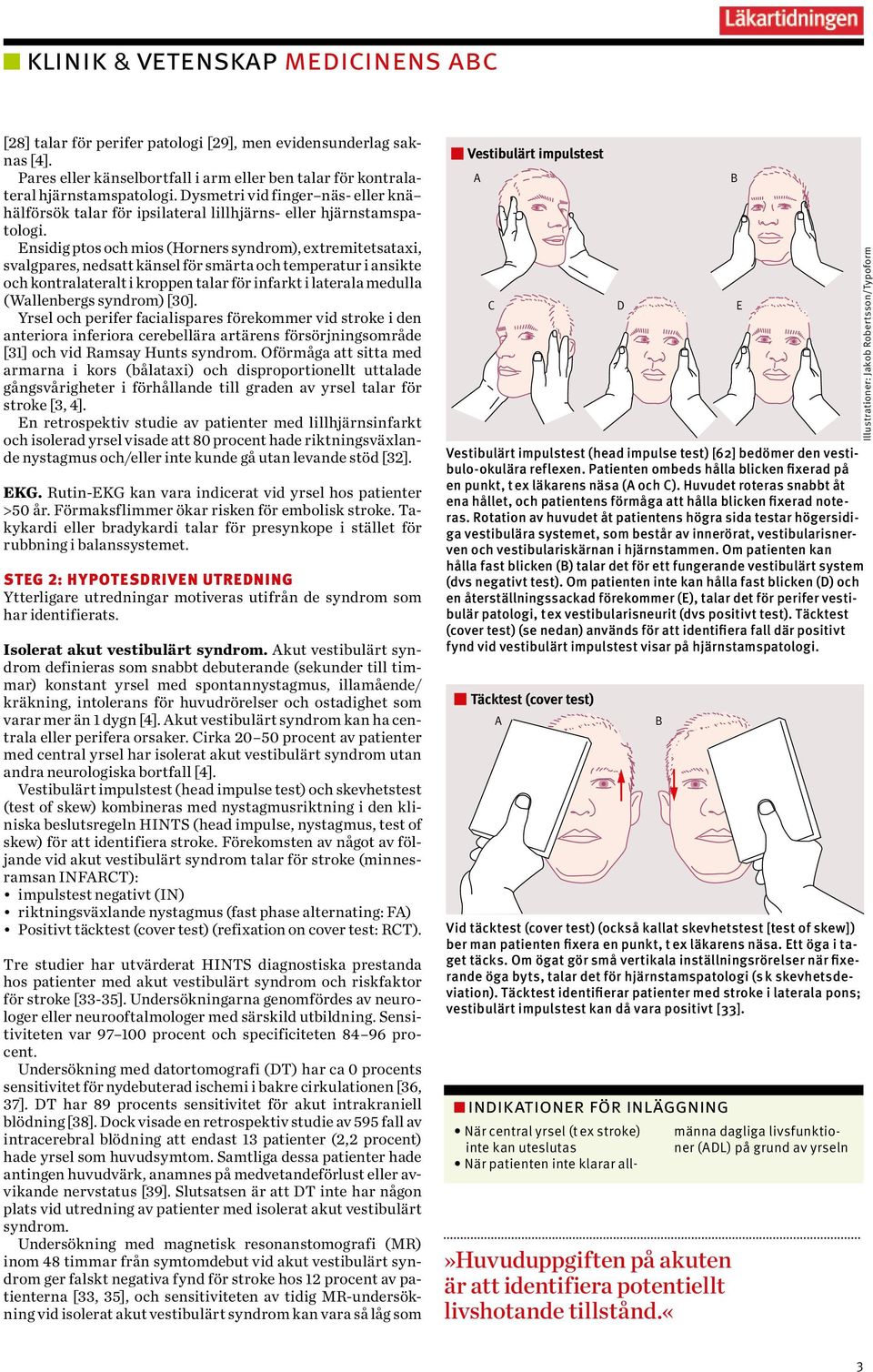 Ensidig ptos och mios (Horners syndrom), extremitetsataxi, svalgpares, nedsatt känsel för smärta och temperatur i ansikte och kontralateralt i kroppen talar för infarkt i laterala medulla