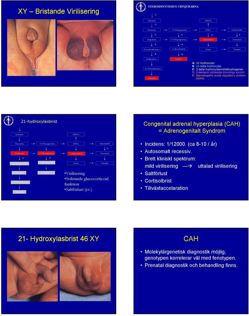 Kolesterol sidokedje klyvnings enzym E: Steroidogenic acute regulatory protein (StAR) Kolesterol 21-hydroxylasbrist DHEAS Congenital adrenal hyperplasia (CAH) = Adrenogenitalt Syndrom Prenenolon