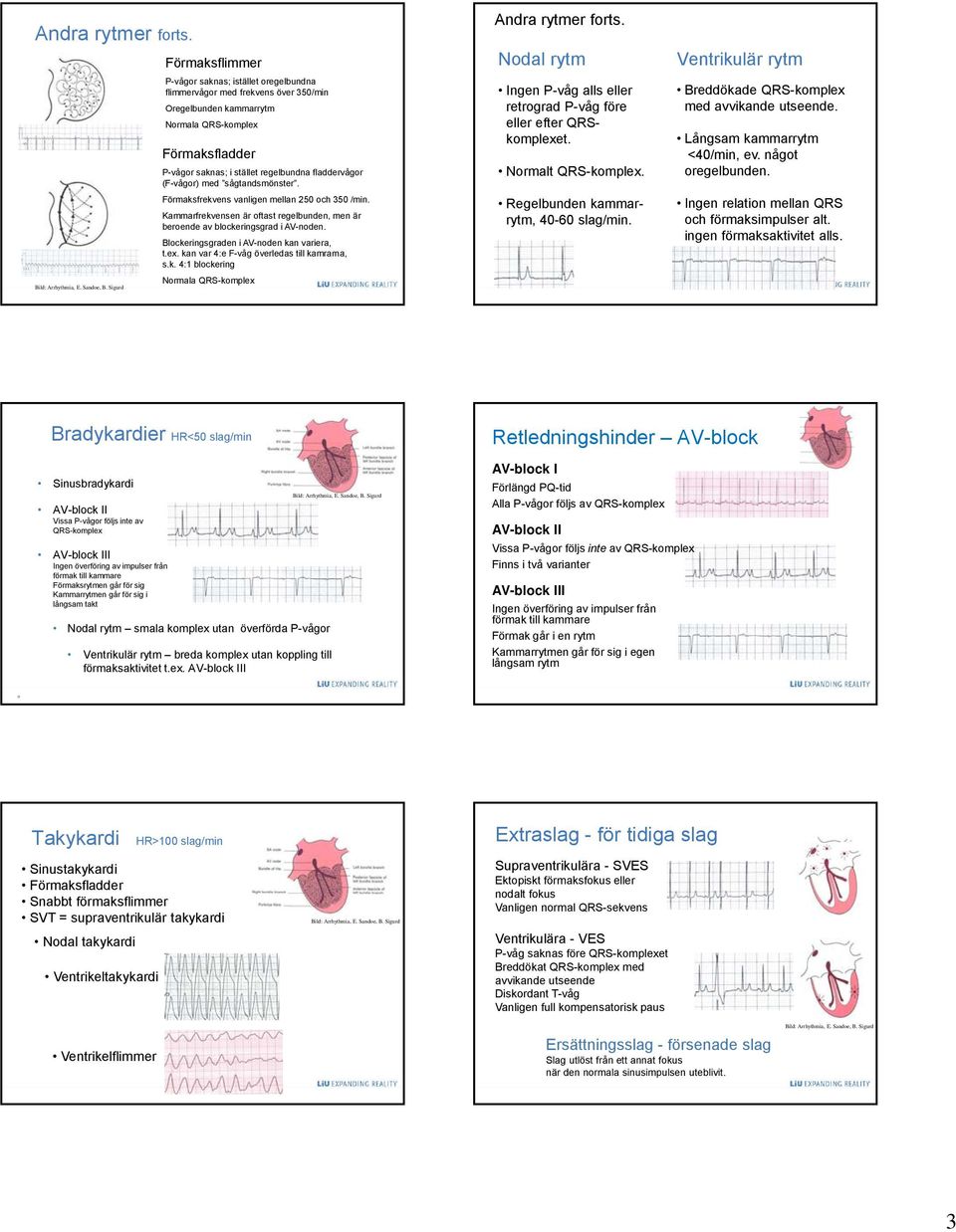 fladdervågor (F-vågor) med sågtandsmönster. Förmaksfrekvens vanligen mellan 250 och 350 /min. Kammarfrekvensen är oftast regelbunden, men är beroende av blockeringsgrad i AV-noden.