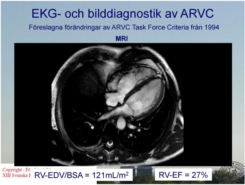 Task Force Criteria från 1994