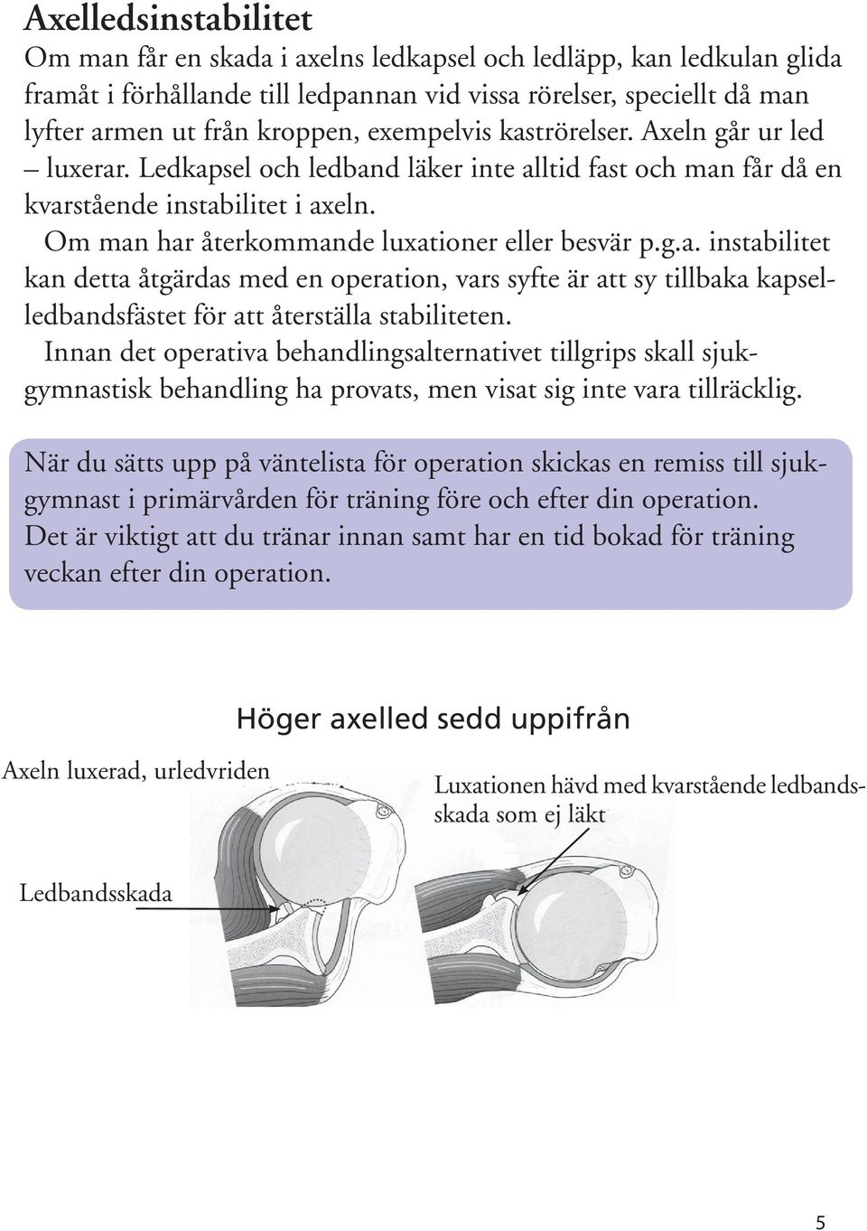 Innan det operativa behandlingsalternativet tillgrips skall sjukgymnastisk behandling ha provats, men visat sig inte vara tillräcklig.