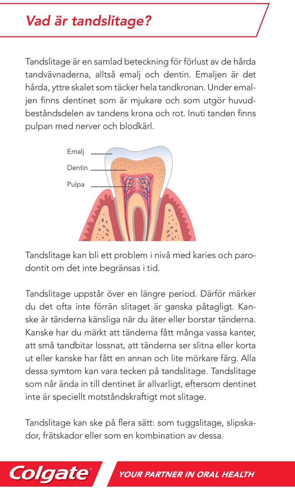 Emalj Dentin Pulpa Tandslitage kan bli ett problem i nivå med karies och parodontit om det inte begränsas i tid. Tandslitage uppstår över en längre period.