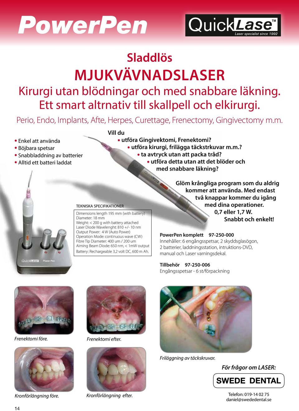 utföra kirurgi, frilägga täckstrkuvar m.m.? ta avtryck utan att packa tråd? utföra detta utan att det blöder och med snabbare läkning?