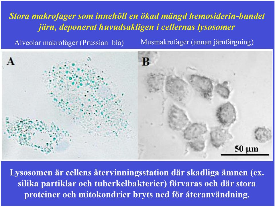 50 µm Lysosomen är cellens återvinningsstation där skadliga ämnen (ex.