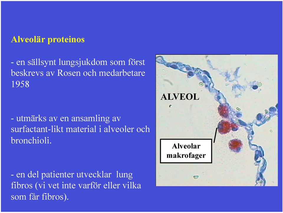 material i alveoler och bronchioli.