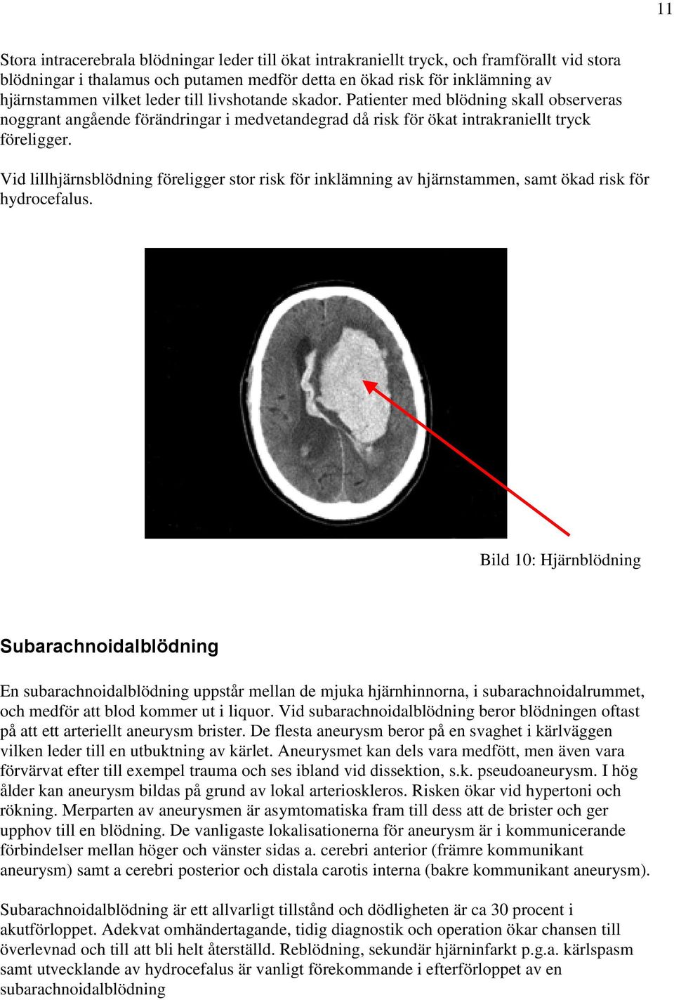 Vid lillhjärnsblödning föreligger stor risk för inklämning av hjärnstammen, samt ökad risk för hydrocefalus.