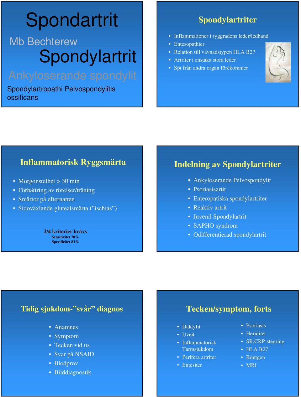 Sidoväxlande glutealsmärta ( ischias ) 2/4 kriterier krävs Sensitivitet 70% Specificitet 81% Indelning av Spondylartriter Ankyloserande Pelvospondylit Psoriasisartit Enteropatiska spondylartriter