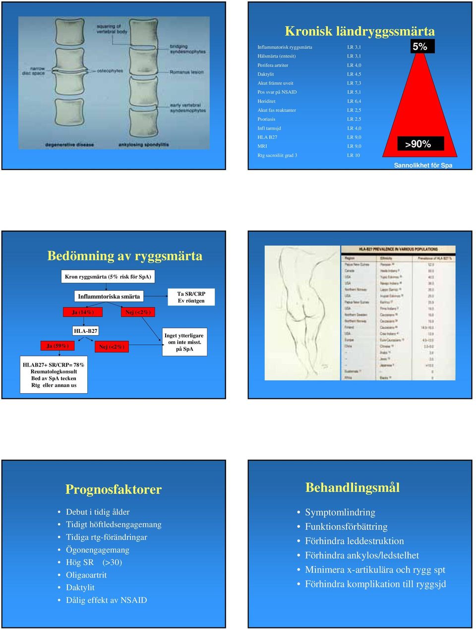 5 Infl tarmsjd LR 4,0 HLA B27 LR 9,0 MRI LR 9,0 Rtg sacroiliit grad 3 LR 10 5% >90% Sannolikhet för Spa Bedömning av ryggsmärta Kron ryggsmärta (5% risk för SpA) Inflammtoriska smärta Ja (14%) Nej