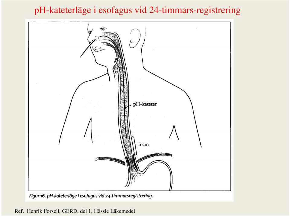 24-timmars-registrering