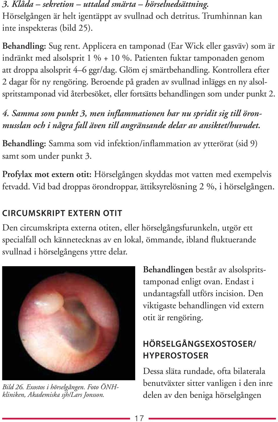 Kontrollera efter 2 dagar för ny rengöring. Beroende på graden av svullnad inläggs en ny alsolspritstamponad vid återbesöket, eller fortsätts behandlingen som under punkt 2. 4.