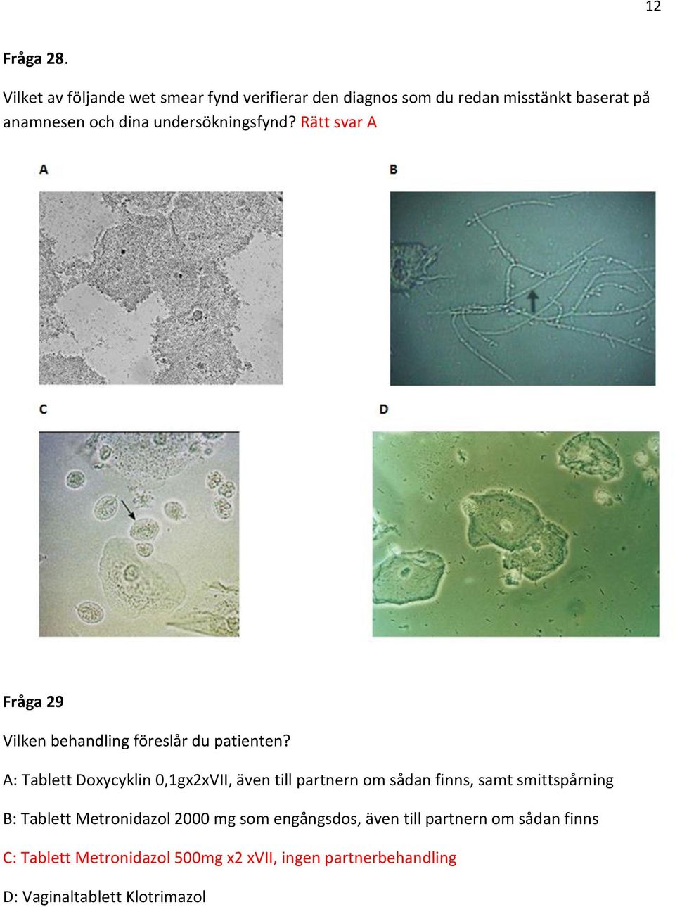 undersökningsfynd? Rätt svar A Fråga 29 Vilken behandling föreslår du patienten?