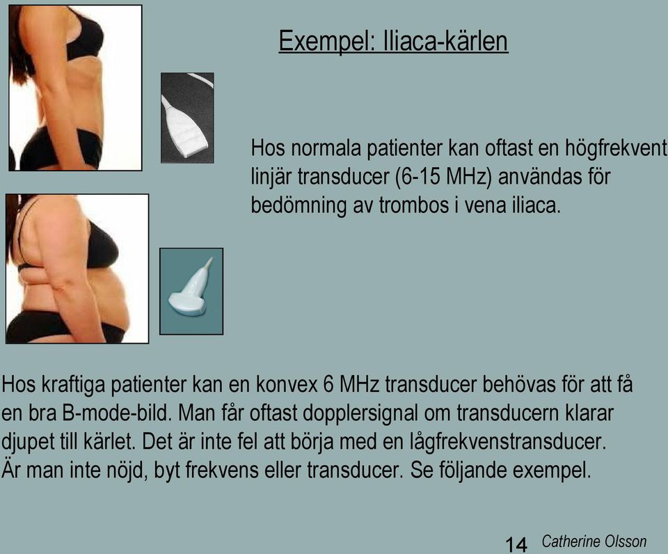 Hos kraftiga patienter kan en konvex 6 MHz transducer behövas för att få en bra B-mode-bild.