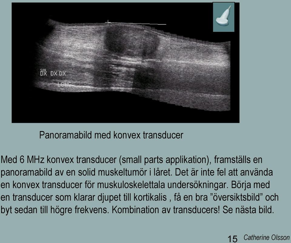 Det är inte fel att använda en konvex transducer för muskuloskelettala undersökningar.