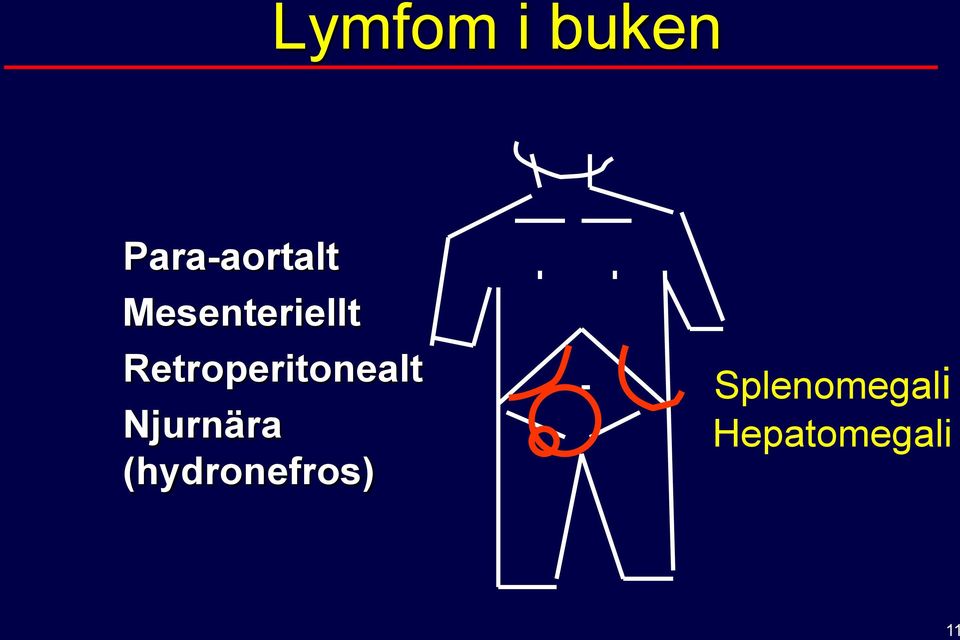 Retroperitonealt Njurnära