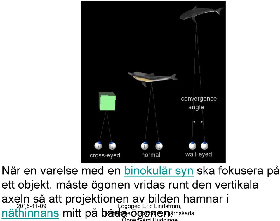 att projektionen av bilden hamnar i Logoped Eric